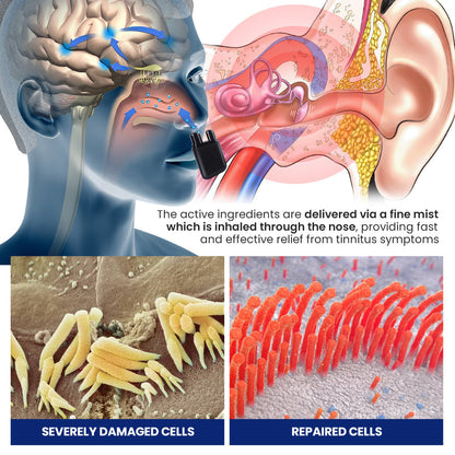 LUHAKA™ Sonose Tinnitus Relief Dual Nasal Inhaler 🏆