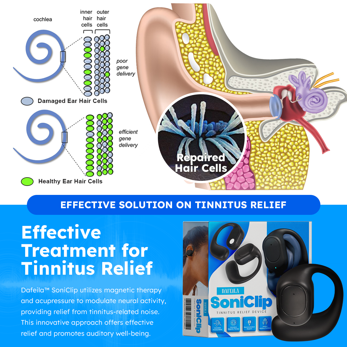 DAFEILA™ SoniClip Tinnitus Relief Device 🔥