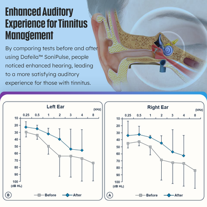 DAFEILA™ SoniPulse Tinnitus Relief Soothing Aid ⭐️