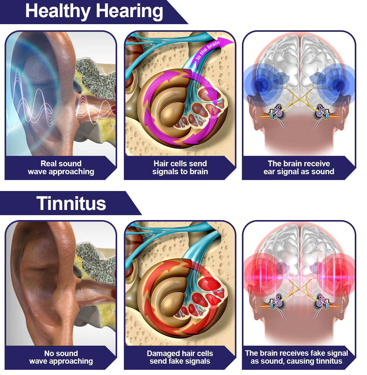 DAFEILA™ INFRAPEACE -Red Light Therapy Ear Plugs ACE4